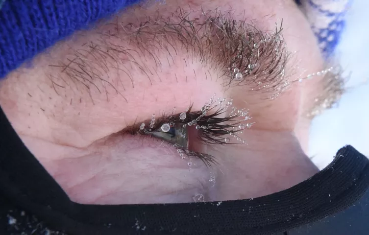 Frost forms on the eyelashes and eyebrows of Jim Leithauser of Cottage Grove, who searches for the 2019 Pioneer Press Treasure Hunt medallion in Long Lake Regional Park in New Brighton Thursday, Jan. 24, 2019. Temperatures were in the single digits, with windchills approaching -20 degrees. "I'm a lifer...40+ years," said Leithauser, (Jean Pieri / Pioneer Press)
